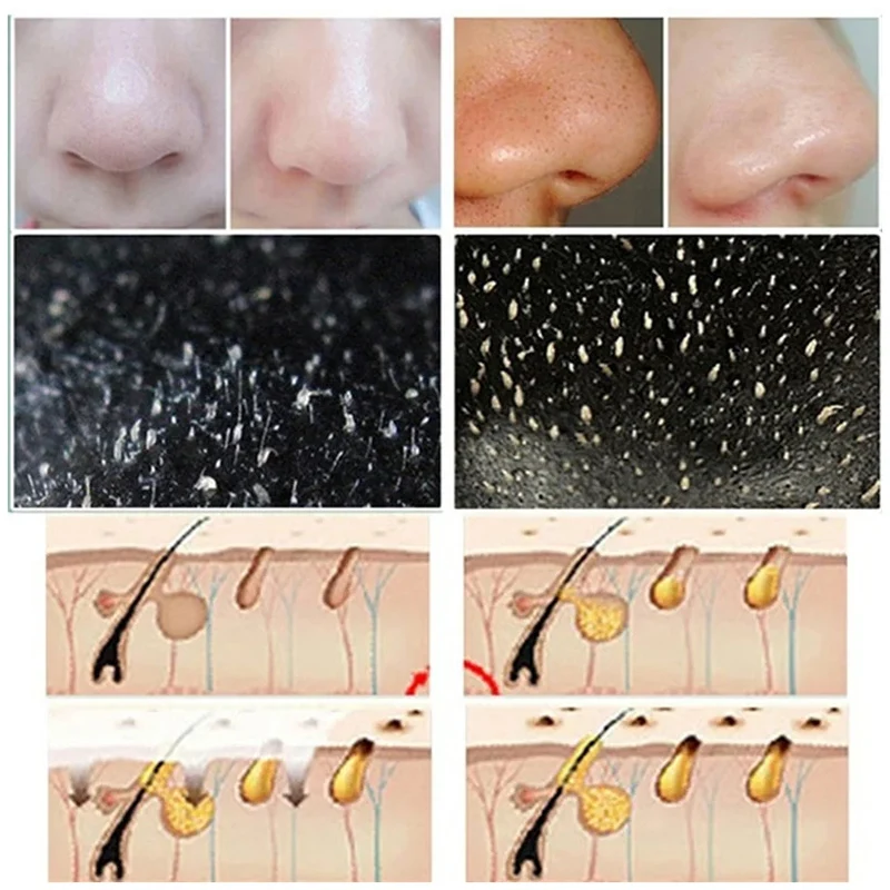 10 adet Siyah Nokta Burun Şeri - Cleanser Face incelemesi ve fiyatı