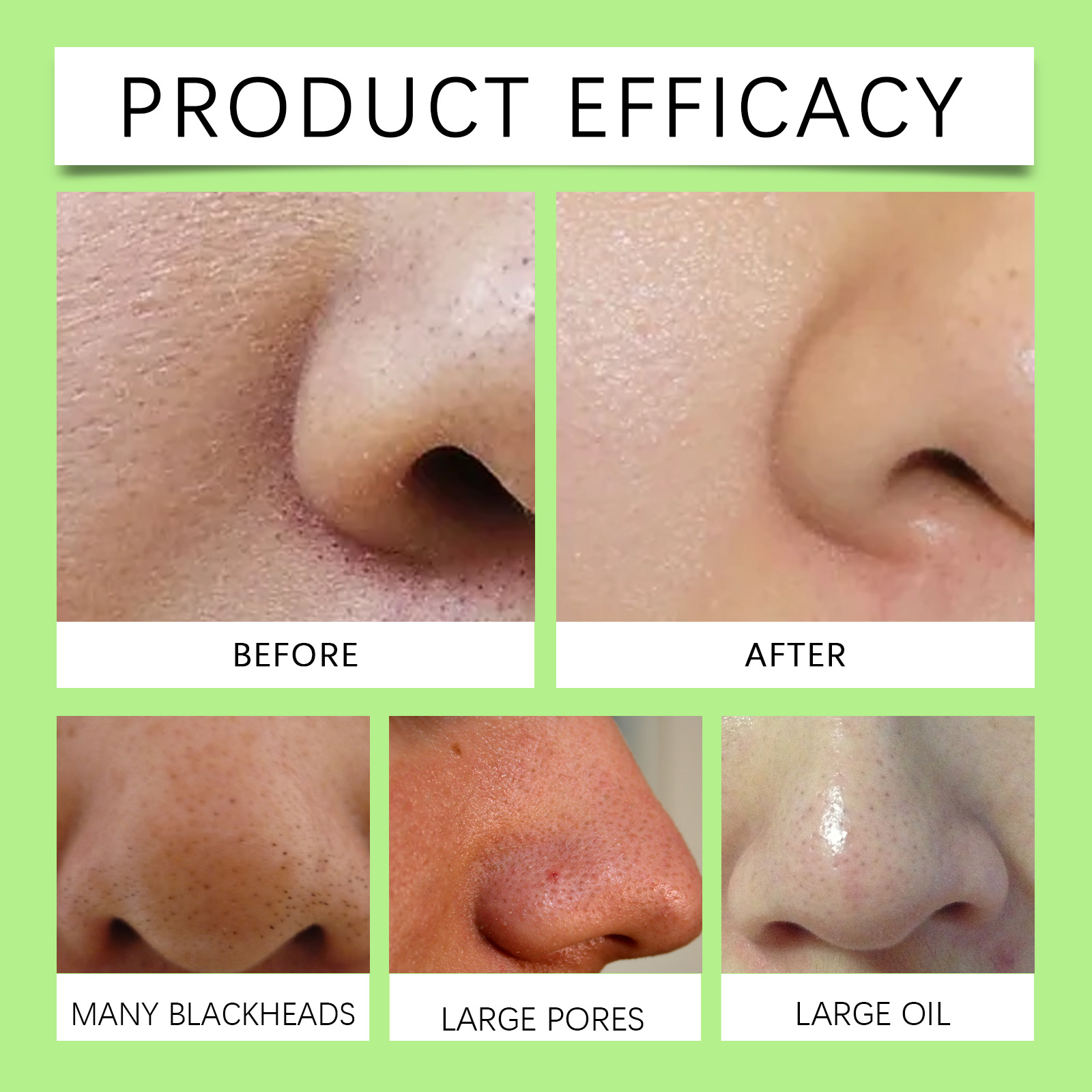 Siyah Noktalar İçin Bambu Kömü - Cleanser Face incelemesi ve fiyatı